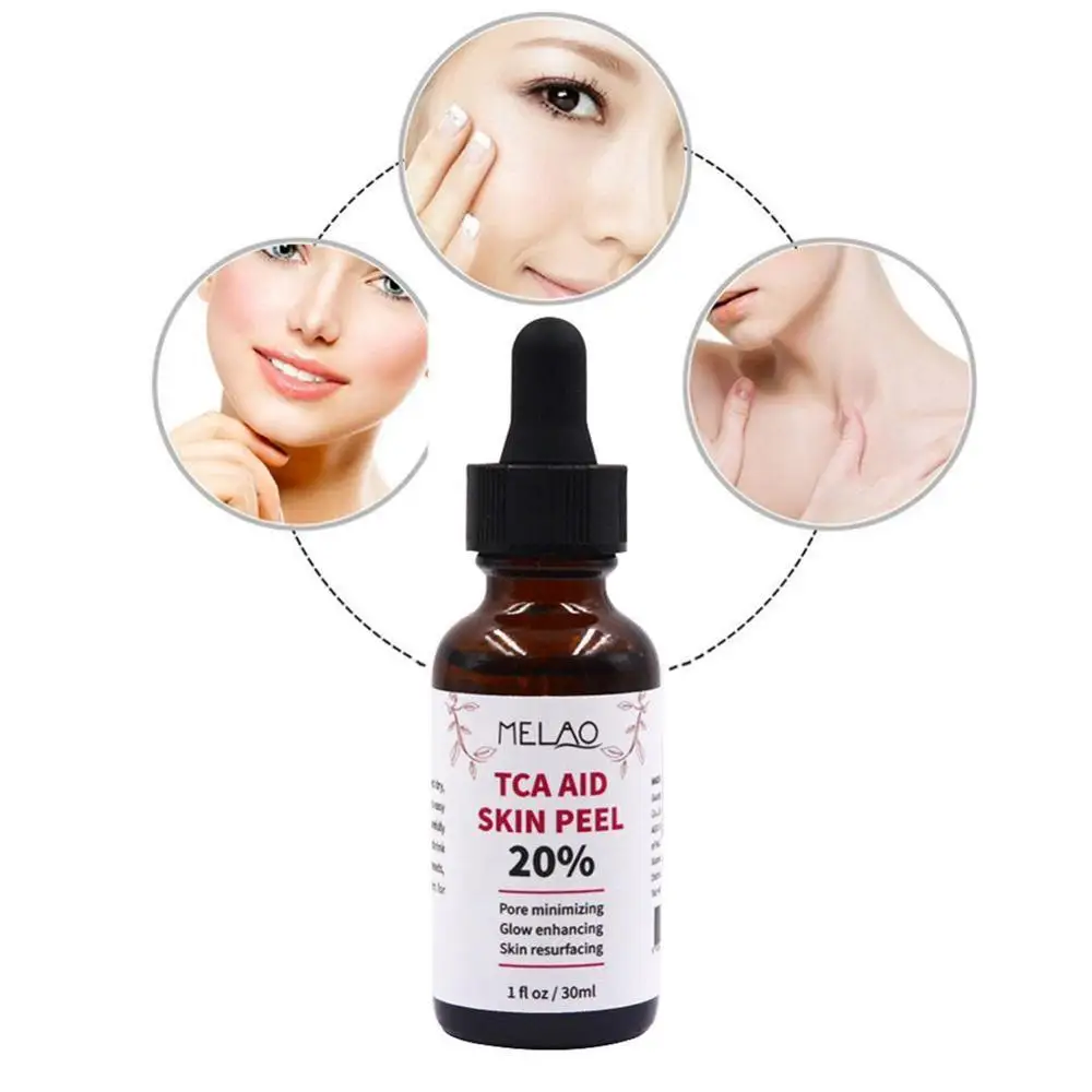 30 ml Trichloroaectic Acid 20% Skin Peel Pore Minizing Rynker Spots Skin Care Face Serum 1