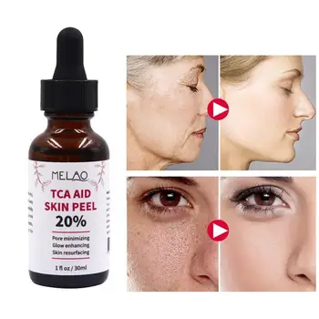 30 ml Trichloroaectic Acid 20% Skin Peel Pore Minizing Rynker Spots Skin Care Face Serum 0