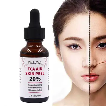 30 ml Trichloroaectic Acid 20% Skin Peel Pore Minizing Rynker Spots Skin Care Face Serum 2