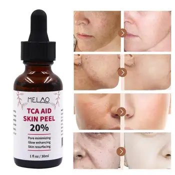 30 ml Trichloroaectic Acid 20% Skin Peel Pore Minizing Rynker Spots Skin Care Face Serum 4