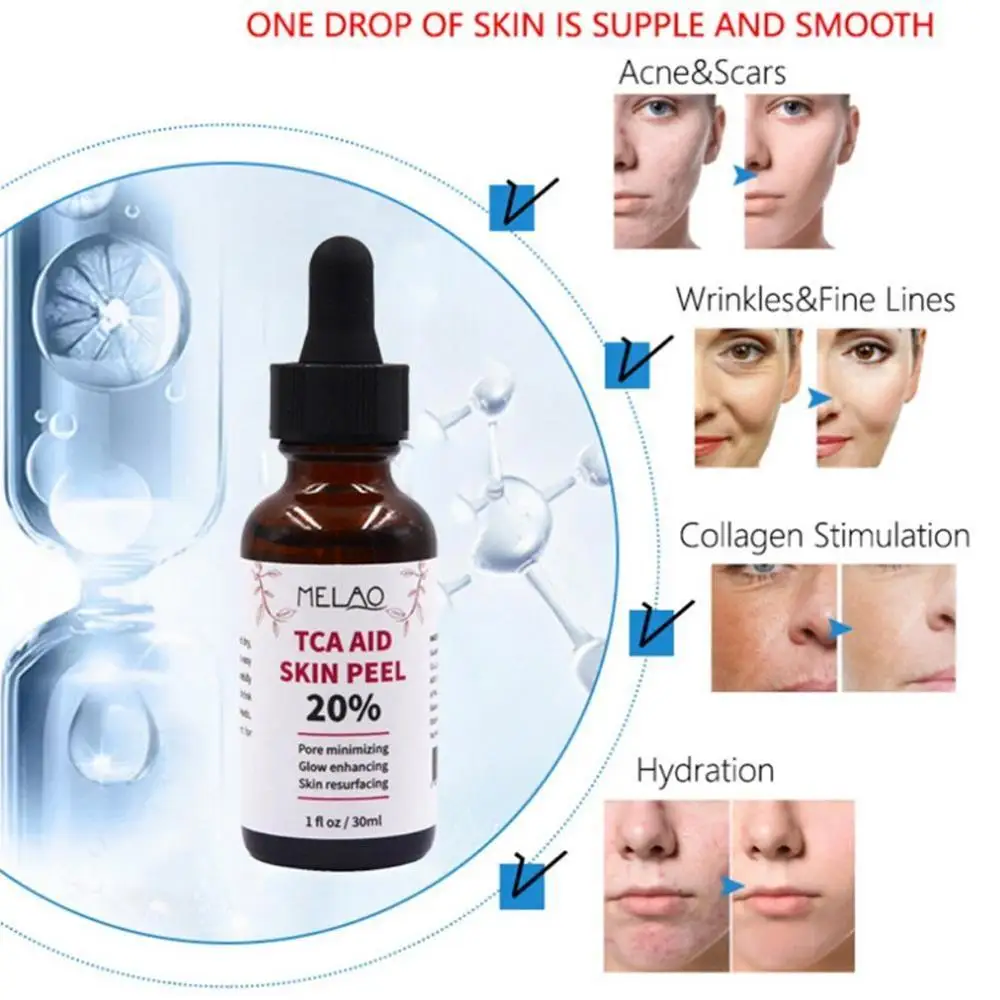 30 ml Trichloroaectic Acid 20% Skin Peel Pore Minizing Rynker Spots Skin Care Face Serum 5