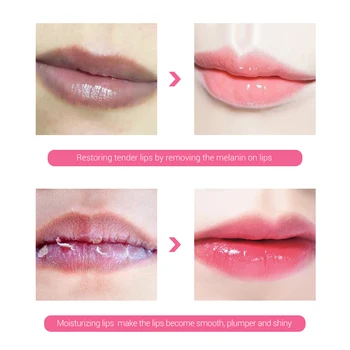 LANBENA Makeup, Læift, Lip Lightening Serum Lip Gloss Fugtgivende Fjerne Melanin Pink Læber Langvarig Kosmetik Plumper Værktøj 2
